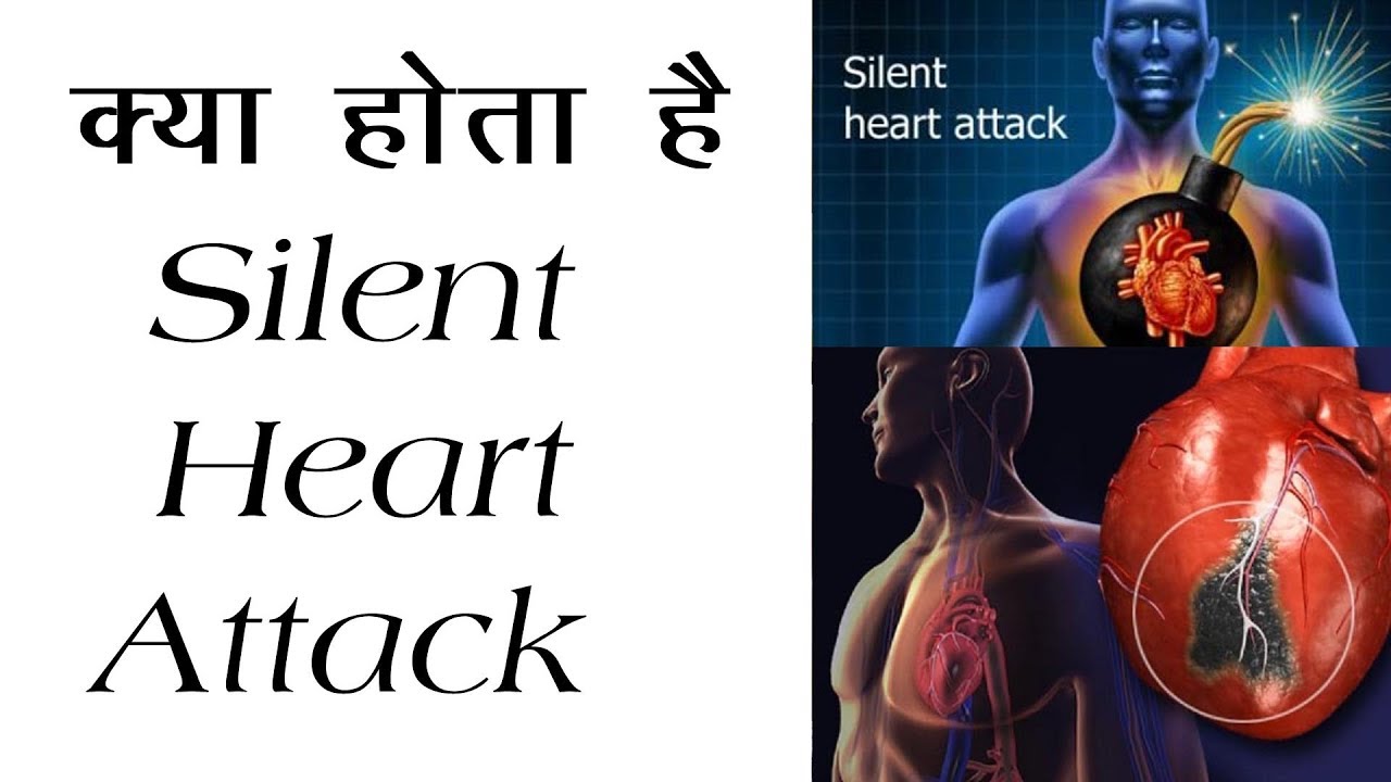 क्या होता हैं साइलेंट हार्ट अटैक? WHAT IS SILENT HEART ATTACK?