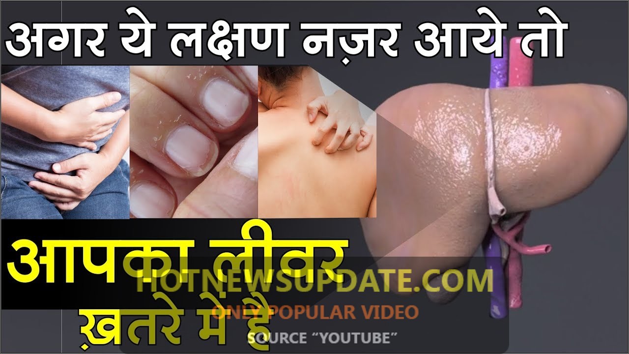 यह 10 लक्षण नजर आएं तो तुरंत अपने लीवर की जांच करवाएं | Liver Test